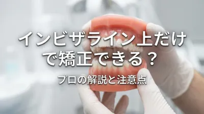インビザライン上だけで矯正できる？