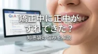 矯正中に正中がずれてきた?知恵袋の悩みを解説