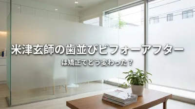 米津玄師の歯並びビフォーアフターは矯正でどう変わった？
