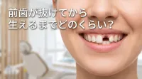 前歯が抜けてから生えるまでどのくらい？