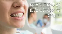 矯正で口の中が傷だらけなのは普通？