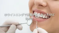 ホワイトニングで歯茎が白くなったけど治る？