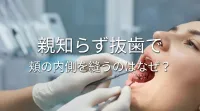 親知らず抜歯で頬の内側を縫うのはなぜ？