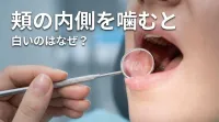 頬の内側を噛むと白いのはなぜ？
