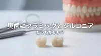 奥歯にセラミックとジルコニア、どっちがいい?