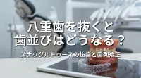 八重歯を抜くと歯並びはどうなる？