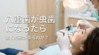 八重歯が虫歯になったら抜く必要があるのか？