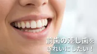 前歯の差し歯をきれいにしたい！