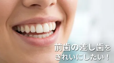 前歯の差し歯をきれいにしたい！