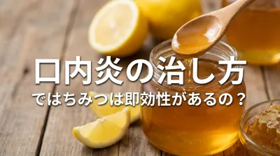 口内炎の治し方ではちみつは即効性があるの？