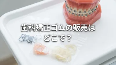 歯科矯正ゴムの販売はどこで？