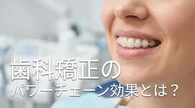 歯科矯正のパワーチェーン効果とは？