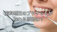 歯科矯正のブラケットが取れる原因は？
