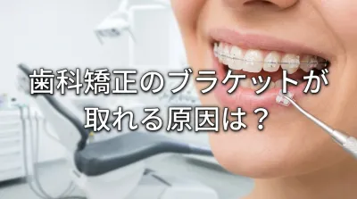 歯科矯正のブラケットが取れる原因は？