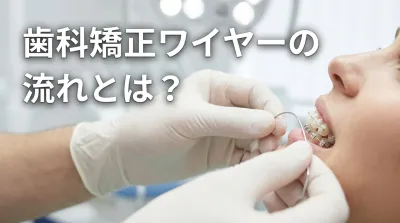 歯科矯正ワイヤーの流れとは？