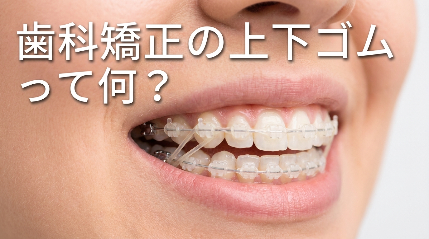 歯科矯正の上下ゴムって何？