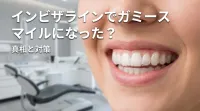インビザラインでガミースマイルになった？
