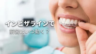 インビザラインで前歯はいつ動く?