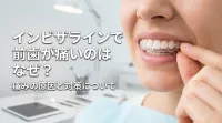 インビザラインで前歯が痛いのはなぜ？