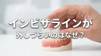 インビザラインが外しづらいのはなぜ？