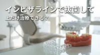 インビザラインで抜歯して上だけ治療できる？