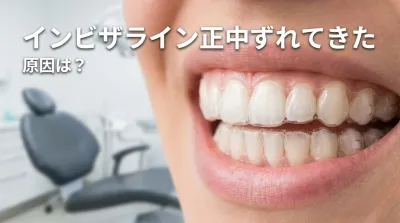 インビザライン正中ずれてきた原因は？